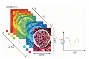 高光譜圖像技術(shù)在醫(yī)學(xué)診斷中的重要性